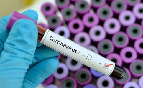 a2acaf5-coronavirus (1)